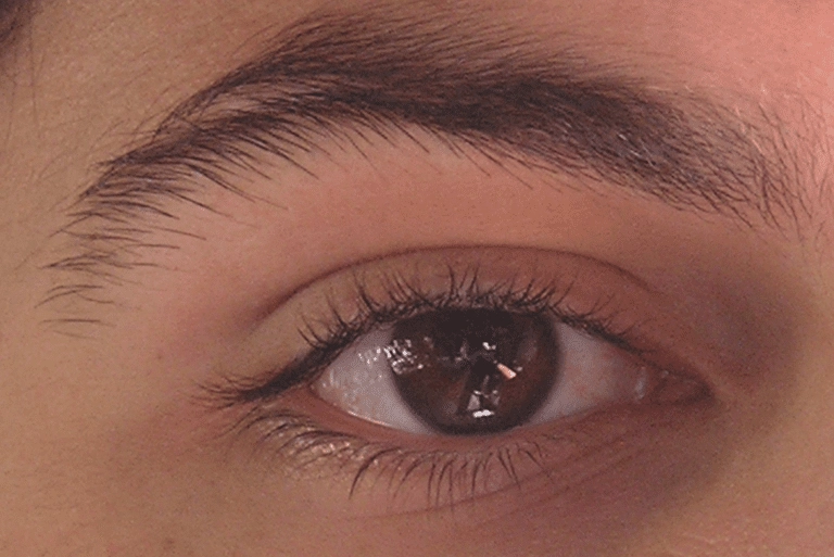 Bipolar Eyes