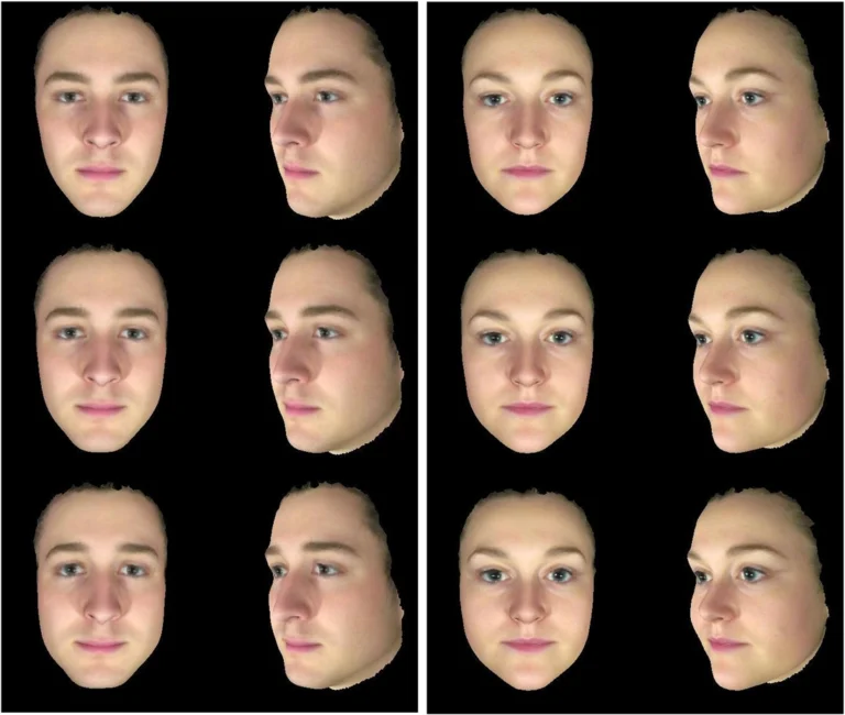 Bipolar Facial Features: Things You Need to Know